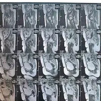 نوبت ام آر آی رادیولوژی لحظه ای همان روز