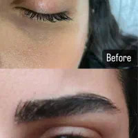 ژل،بوتاکس،پی آرپی،میکرونیدلینگ|خدمات آرایشگری و زیبایی|اصفهان, خانه اصفهان|دیوار