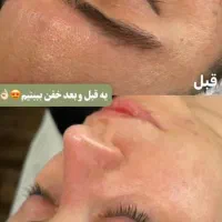 پاکسازی تخصصی تضمینی(آقاوخانم)اف۵۰درصد ولنتاین