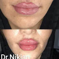 تخفیف ویژه افتتاحیه کلینیک زیبایی دکتر نیک جان