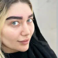 کاشت دائمی ابروو تضمینی