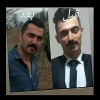 چاقی کل بدن