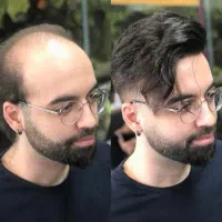 خدا حافظی با بی مویی|خدمات آرایشگری و زیبایی|فردیس, فردیس|دیوار