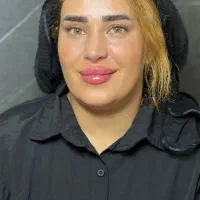 تزریق ژل وبوتاکس|خدمات آرایشگری و زیبایی|جوانرود, |دیوار