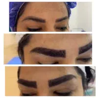 کاشت ابرو به مدت‌یکهفته ۱۲ و‌۵۰۰ تعداد محدود
