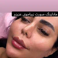 تزریق ژل و بوتاکس پک مادلینگ، مزونیدلینگ ۵۰٪تخفیف|خدمات آرایشگری و زیبایی|پردیس, فاز ۱|دیوار