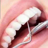 جشنواره ویژه ایمپلنت دندان اقساط