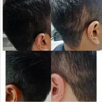 آموزش خدمات میکرواسکالپ کاشت اسکالپ مو تضمینی|خدمات آرایشگری و زیبایی|مشهد, جانباز|دیوار