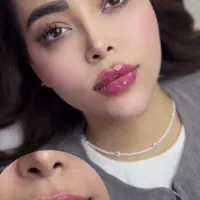 خدمات ژل فیلر بادی باسن بیکینی هیپ دیپ بوتاکس