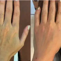 فیلربیکینی وهیپ دیپ وباسن اقساط سی سی250تومان
