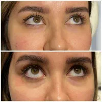 کلینیک تزریق ژل جالپرو لیزر بوتاکس۴۹۰ زاویه پزشک|خدمات آرایشگری و زیبایی|تهران, صادقیه|دیوار