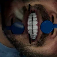 کامپوزیت زیبایی|خدمات آرایشگری و زیبایی|فومن, |دیوار