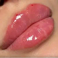 جشنواره طلائی ژل فیلر 1900 بوتاکس 980 فقط 20روز