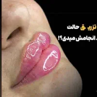 آموزش ژل و بوتاکس فقط ۵۸۰۰