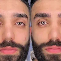 میکروبلیدینگ ابرو آقایان