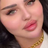 تزریق ژل لب و بوتاکس و زاویه و...