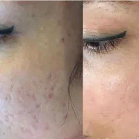 فروش خاویارحلزون درجه یک