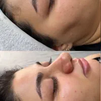 آف ۲۰ درصدی فیشیال تخصصی  به مدت چند روز