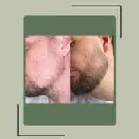 این پکیج خوراک خودته تا قبل از اربعین جذاب شو