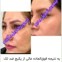 سارا محمدپور هستم|آرایشی، بهداشتی، درمانی|تهران, آزادشهر|دیوار