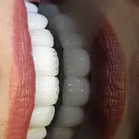 دندانپزشکی بیمه تامین اجتماعی کمیته امدادوبهزیستی|خدمات آرایشگری و زیبایی|نورآباد, |دیوار