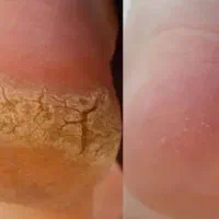 پدیکور و پاکسازی|خدمات آرایشگری و زیبایی|تربت‌حیدریه, شهید قرنی|دیوار