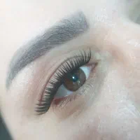 کاشت هیدن