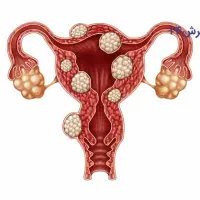 پاکسازیه‌‌ویژه‌بانوان درسه دوره