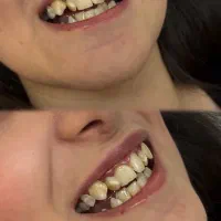 کلینیک دندان پزشکی،کاشت ابرو،ژل|خدمات زیبایی و سلامت|اهواز, کوی ملی راه|دیوار