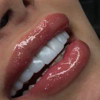 ازدم قسط کامپوزیت انجام بده