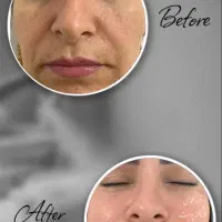 درمان پوست باتخفیف بلک فرایدی/پوست کره‌ای/کاموفلاژ|خدمات آرایشگری و زیبایی|پاکدشت, پاکدشت (مامازند)|دیوار