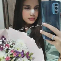 عمل زیبای بینی|خدمات آرایشگری و زیبایی|قائم‌شهر, |دیوار