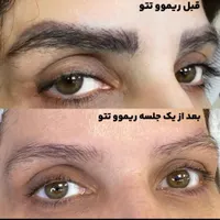 طراحی و قرینه سازی ابرو به روش هیراستروک /موربروز|خدمات آرایشگری و زیبایی|تهران, مجیدیه|دیوار