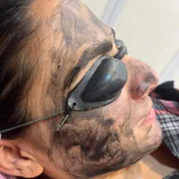 کلنیک زیبایی  لیزر تتو بدن، تزریق ژل و بوتاکس و...|خدمات آرایشگری و زیبایی|اسلام‌شهر, شهرک واوان|دیوار