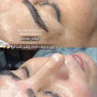 جشنواره تخفیفی فیشال تخصصی صورت|خدمات آرایشگری و زیبایی|مشهد, هفده شهریور|دیوار