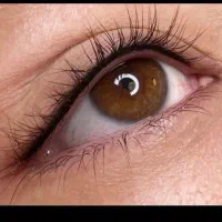 تاتوو وفیبروز