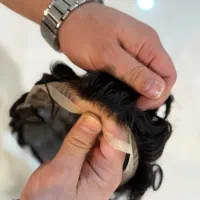 پروتز مو