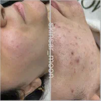 فیشال تخصصی. پاکسازی