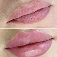خانه ی لیزر آیدالین شهرک ارم (پوست وزیبایی )|خدمات زیبایی و سلامت|تبریز, |دیوار