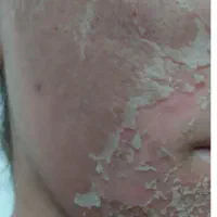 پاکسازی صورت مطب دکتر آذین اسکندری|خدمات آرایشگری و زیبایی|دوگنبدان, |دیوار