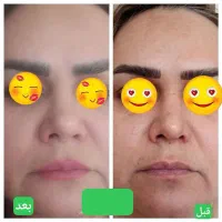 راز پوست شفاف و جوون