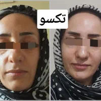 درمان تمامی مشکلات با محصولات ماسکانی|آرایشی، بهداشتی، درمانی|اصفهان, باغ فردوس|دیوار