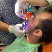 ایمپلنت فقط هفت میلیون و نهصد ضمانتی|خدمات آرایشگری و زیبایی|رشت, گلسار|دیوار