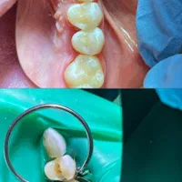 دندانپزشکی در آخونی|خدمات آرایشگری و زیبایی|تبریز, |دیوار