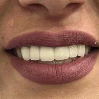 استخدام دستیار و منشی دندانپزشک