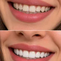 دندانپزشکی و دندانسازی پوران