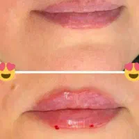 ژل و بوتاکس 650(آموزش)|خدمات آرایشگری و زیبایی|شیراز, معالی‌آباد|دیوار