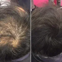 تو باورت نمیشه ولی همینقدر ساده موهات پر میشه