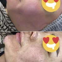 انجام کلیه خدمات پاکسازی پوست بصورت کاملا تخصصی