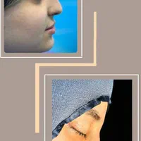 عمل بینی ۲۵میلیون چکی|خدمات آرایشگری و زیبایی|رشت, دیلمان|دیوار